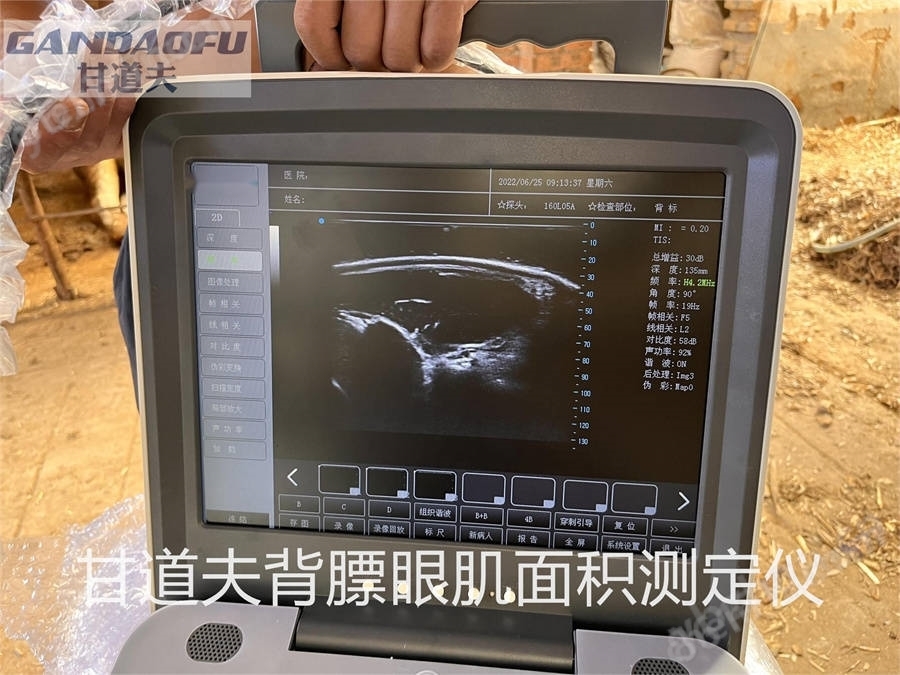 獸用B超牛羊背膘眼肌測定儀廠家價格報價